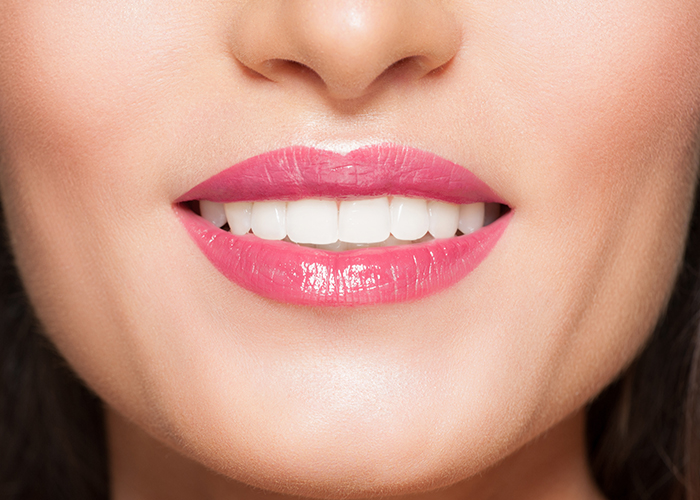 Invisalign